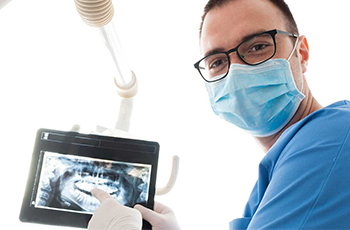 male dental assistant wearing mask pointing at radiograph in dental setting